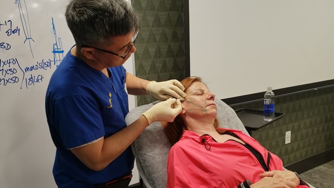 Doctor performing PDO thread lift on patient, demonstrating non-invasive skin tightening procedure in medical setting.